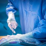 Personalised Surgery for Cancer of the Colon and Rectum